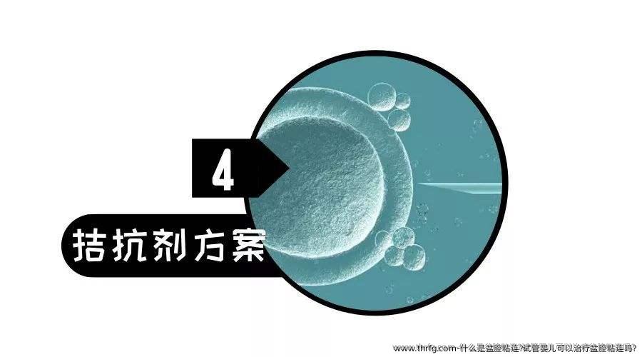 什么是盆腔粘连?试管婴儿可以治疗盆腔粘连吗?