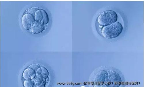 试管婴儿要多少钱？西安能用社保吗？