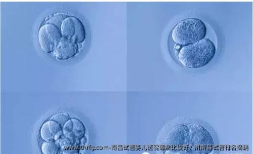南昌试管婴儿医院哪家比较好？附南昌试管排名揭晓