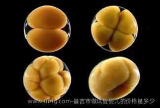 昌吉市做试管婴儿的价格是多少