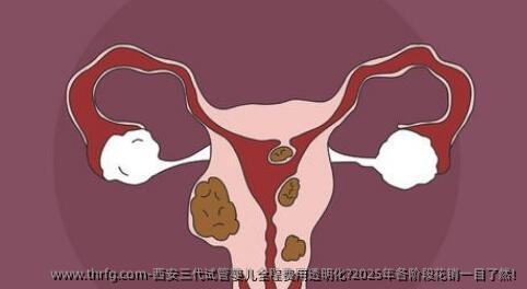 西安三代试管婴儿全程费用透明化?2025年各阶段花销一目了然!