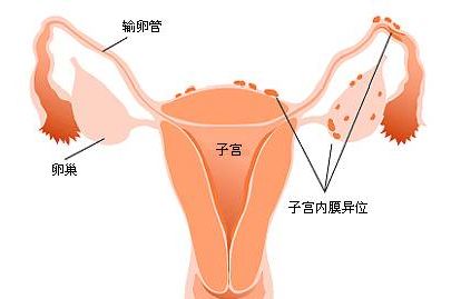 泰国试管婴儿,女性子宫环境