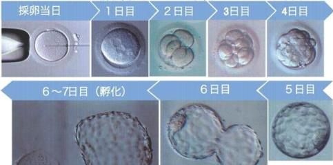 做泰国第三代试管婴儿第3天和第5天筛查的差别