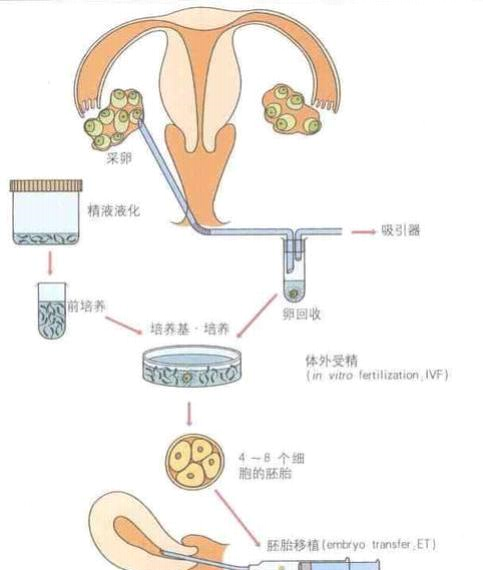 试管婴儿的过程、方法和费用？