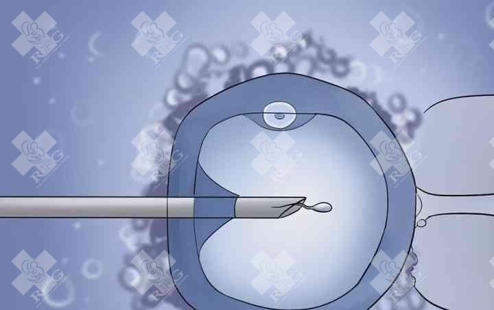 泰国安全生殖中心试管婴儿费用是多少？
