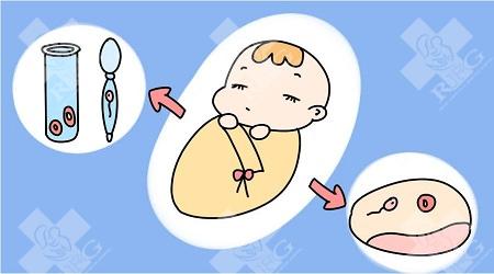 养囊胚的质量主要看精子还是卵子