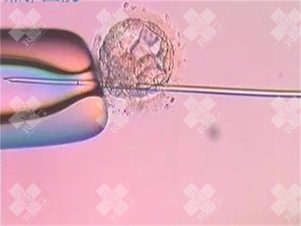 三代试管活检胚胎需要多久？