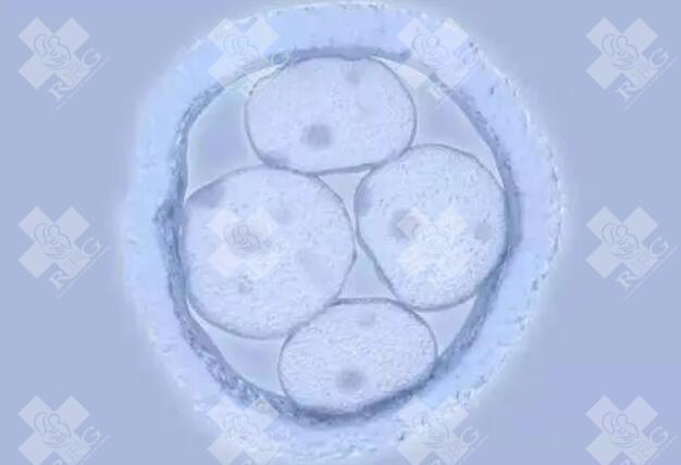 试管助孕中胎停育的原因,胎停育后多久才可以再次怀孕？