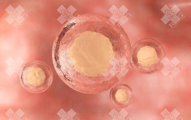 pgd试管能检测出鱼鳞病吗,用什么方法危险性小?