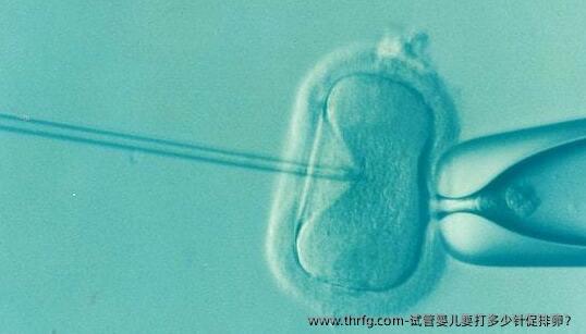 试管婴儿要打多少针促排卵？