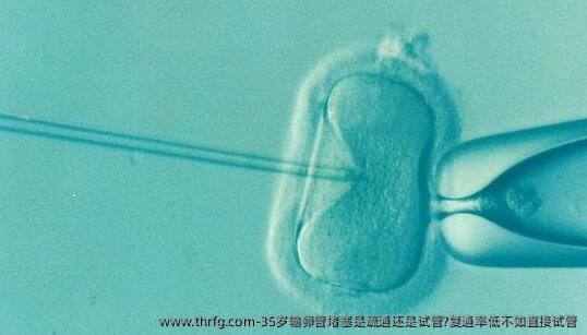35岁输卵管堵塞是疏通还是试管?复通率低不如直接试管