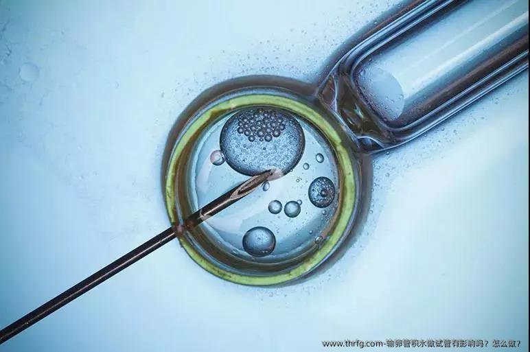 输卵管积水做试管有影响吗？怎么做？