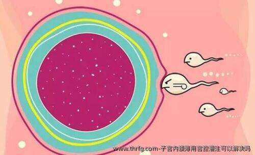子宫内膜薄用宫腔灌注可以解决吗