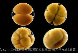 兰州试管婴儿医院哪家专业度高？成功率与成本估算