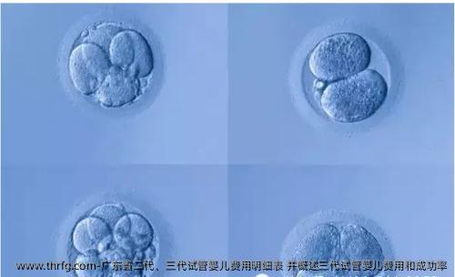 广东省二代、三代试管婴儿费用明细表 并概述三代试管婴儿费用和成功率