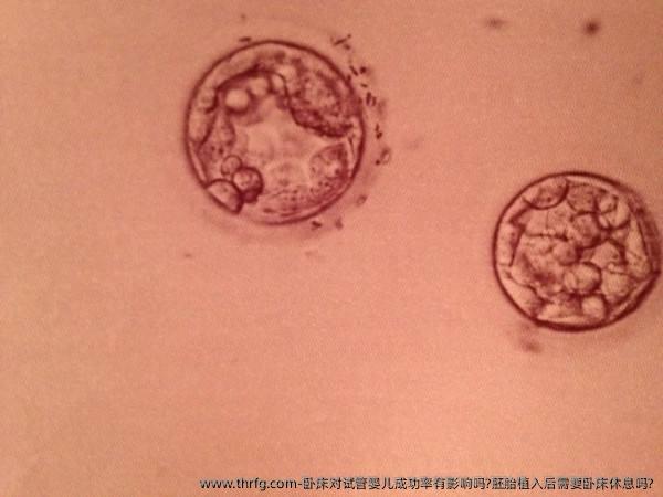 卧床对试管婴儿成功率有影响吗?胚胎植入后需要卧床休息吗?