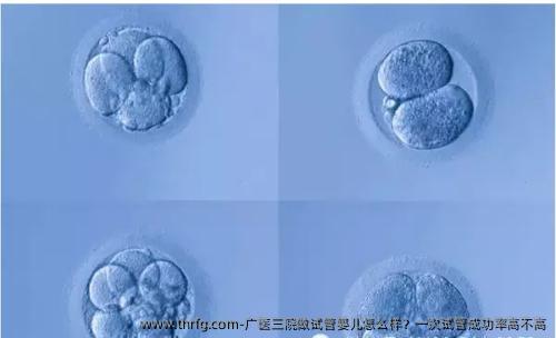 广医三院做试管婴儿怎么样？一次试管成功率高不高