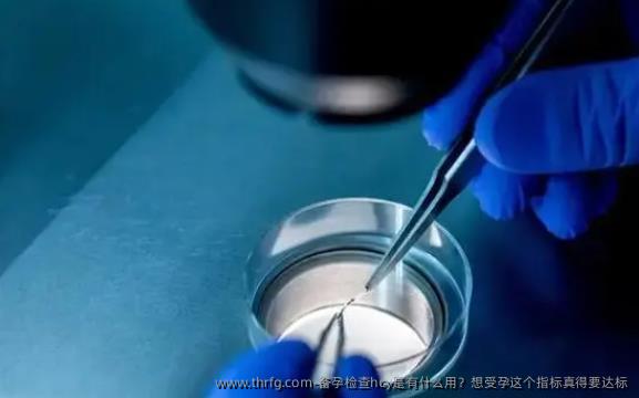 备孕检查hcy是有什么用？想受孕这个指标真得要达标