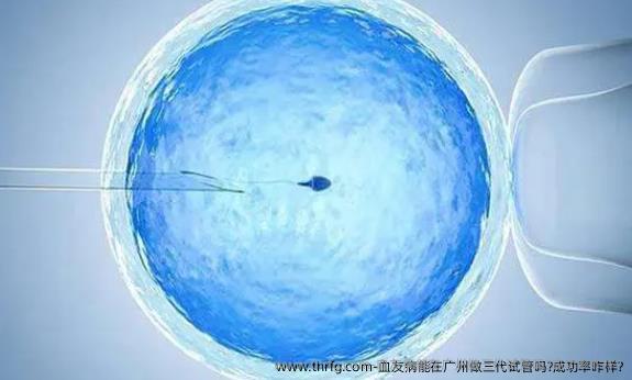 血友病能在广州做三代试管吗?成功率咋样?