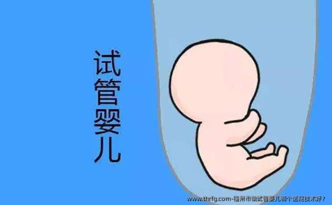 福州市做试管婴儿哪个医院技术好？