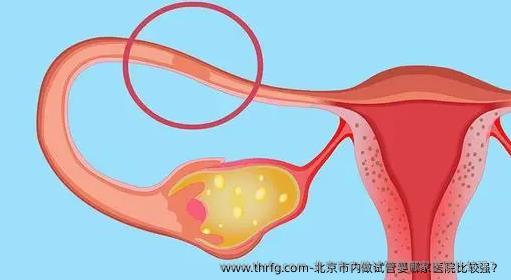 北京市内做试管婴哪家医院比较强？