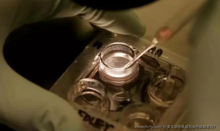 31多次胎停是因为染色体异常吗？