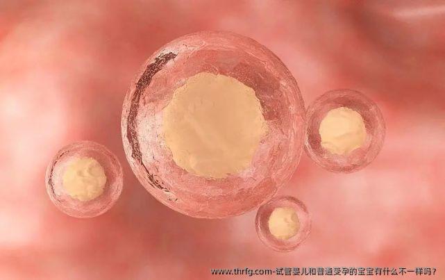 试管婴儿和普通受孕的宝宝有什么不一样吗？