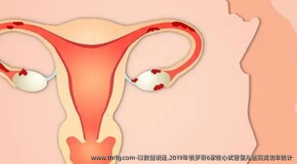 以数据说话,2019年俄罗斯6家核心试管婴儿医院成功率统计