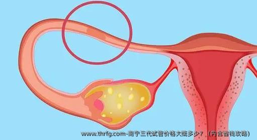 南宁三代试管价格大概多少？（内含省钱攻略）