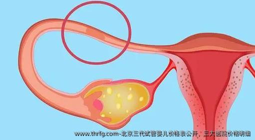 北京三代试管婴儿价格表公开，三大医院价格明细