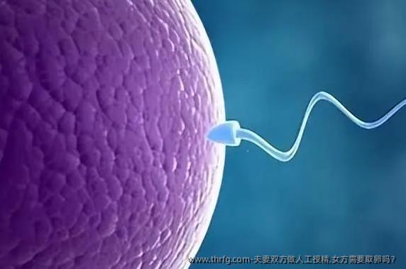 夫妻双方做人工授精,女方需要卵泡取出吗？