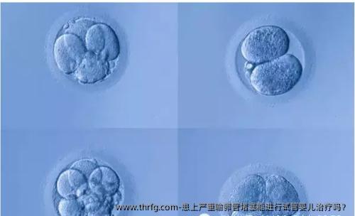 患上严重输卵管堵塞能进行试管婴儿治疗吗？