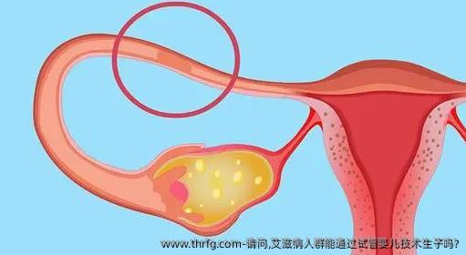 请问,艾滋病人群能通过试管婴儿技术生子吗?
