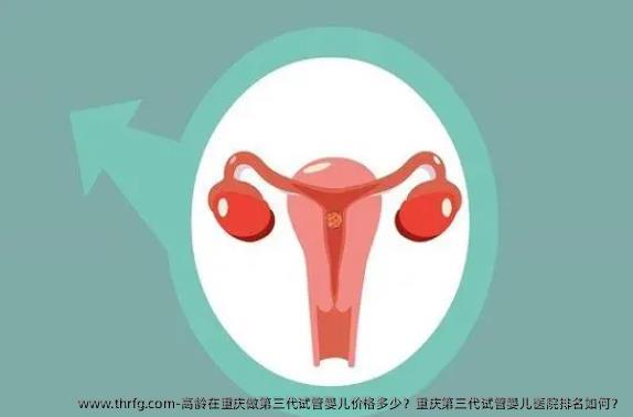 高龄在重庆做第三代试管婴儿价格多少？重庆第三代试管婴儿医院排名如何？