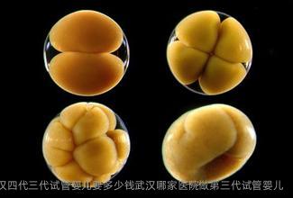 武汉四代三代试管婴儿要多少钱武汉哪家医院做第三代试管婴儿