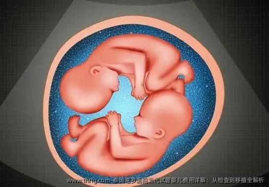 泰国暹罗医院三代试管婴儿费用详解：从检查到移植全解析