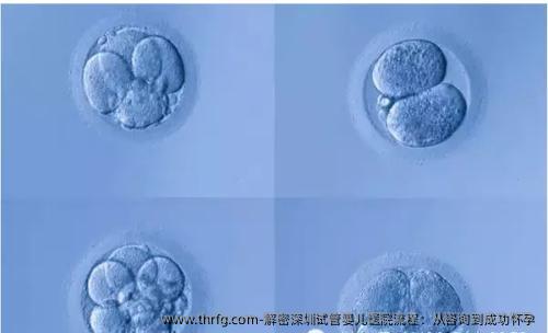 解密深圳试管婴儿医院流程：从咨询到成功怀孕