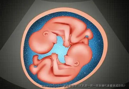 囊胚移植第5天乳房一阵一阵胀痛代表着床成功吗？