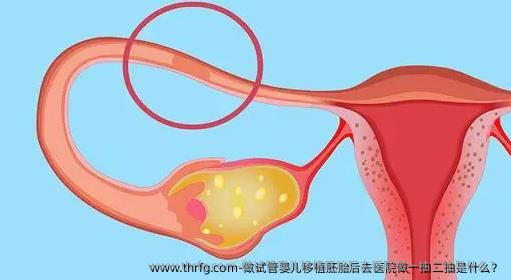 做试管婴儿移植胚胎后去医院做一抽二抽是什么？