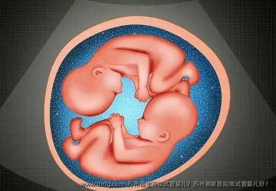 苏州哪里可以试管婴儿？苏州哪家医院做试管婴儿好？