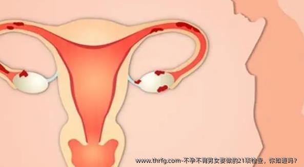 不孕不育男女要做的21项检查，你知道吗？