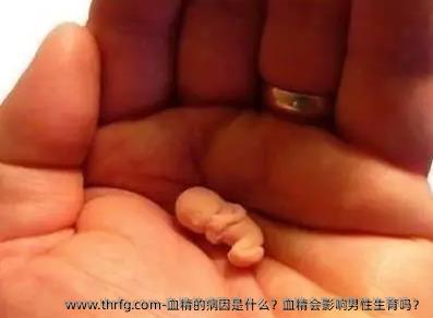 血精的病因是什么？血精会影响男性生育吗？