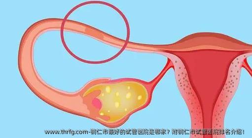 铜仁市较好的试管医院是哪家？附铜仁市试管医院排名介绍！