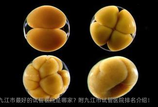 九江市较好的试管医院是哪家？附九江市试管医院排名介绍！