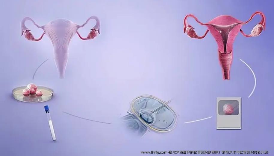 格尔木市较好的试管医院是哪家？附格尔木市试管医院排名介绍！