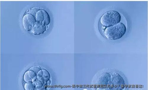 扬中做三代试管费用总共多少？备孕家庭看这！