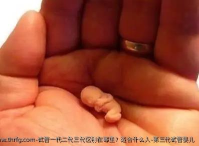 试管一代二代三代区别在哪里？适合什么人-第三代试管婴儿