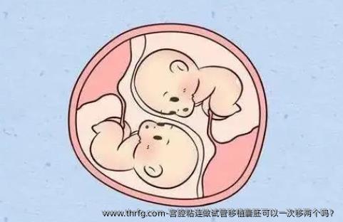 宫腔粘连做试管移植囊胚可以一次移两个吗？