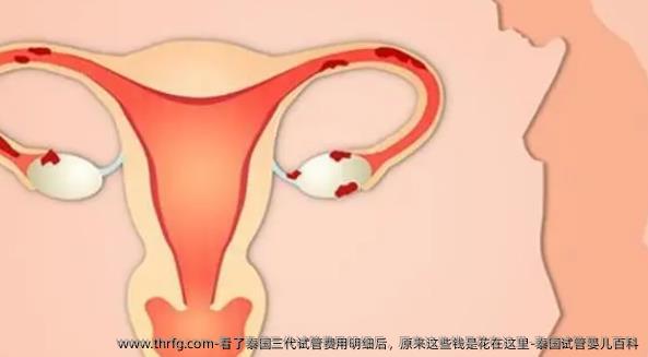 看了泰国三代试管费用明细后，原来这些钱是花在这里-泰国试管婴儿百科