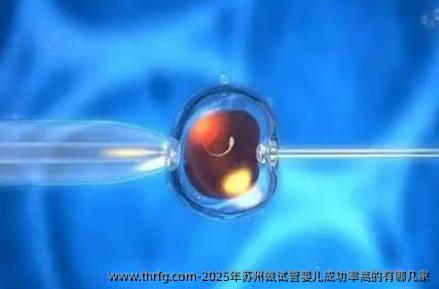 2025年苏州做试管婴儿成功率高的有哪几家